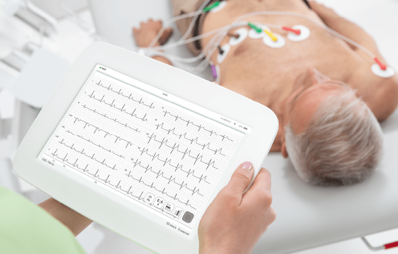 ECG (Málaga capital / Málaga city)