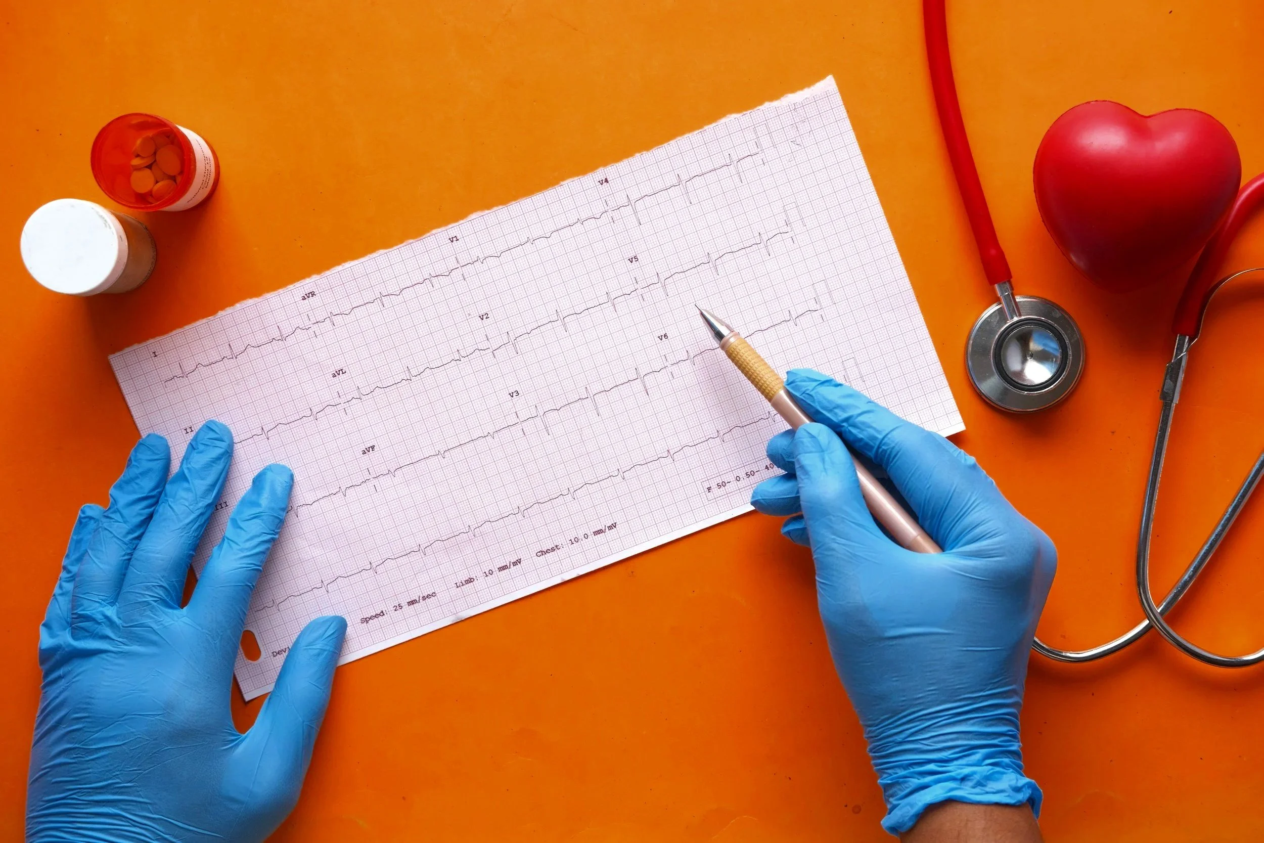 A person wearing blue gloves is analyzing an electrocardiogram (ECG) on a sheet of graph paper with a pen. There is a stethoscope, a heart-shaped object, and medicine bottles on an orange table.