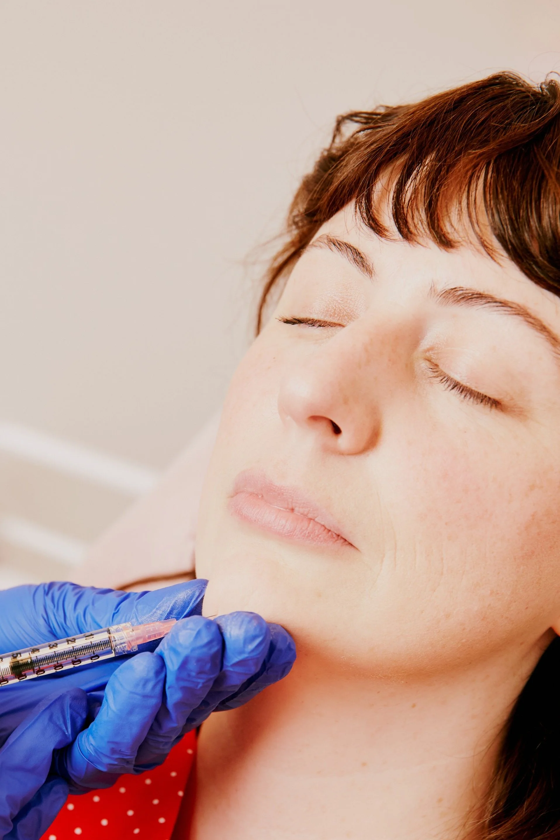 Facial Dermal Fillers For Natural Results