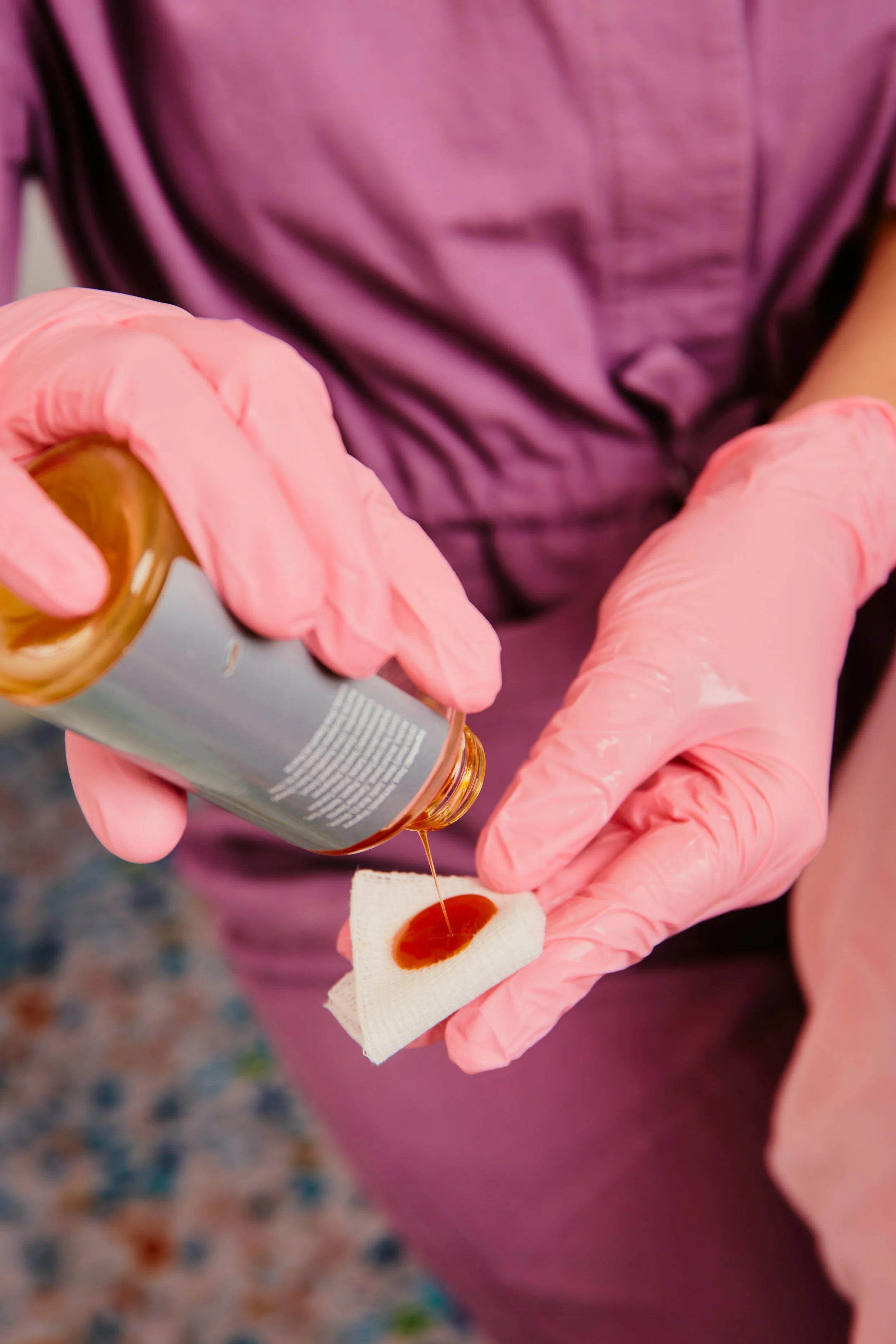 Chemical Peel Treatment For Exfoliation, Acne, Skin Texture And Rejuvenation