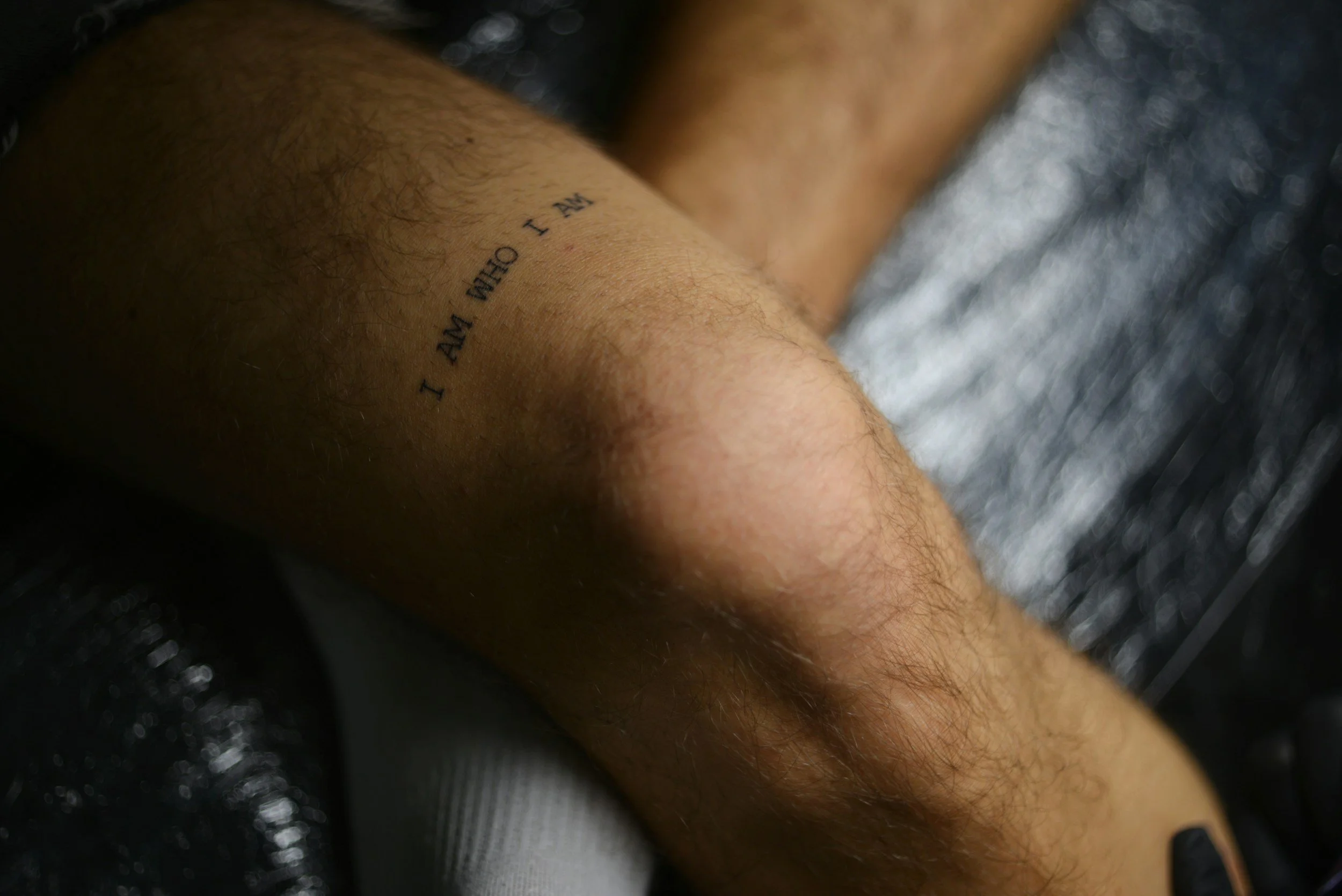 Knee Osteoarthritis (OA)