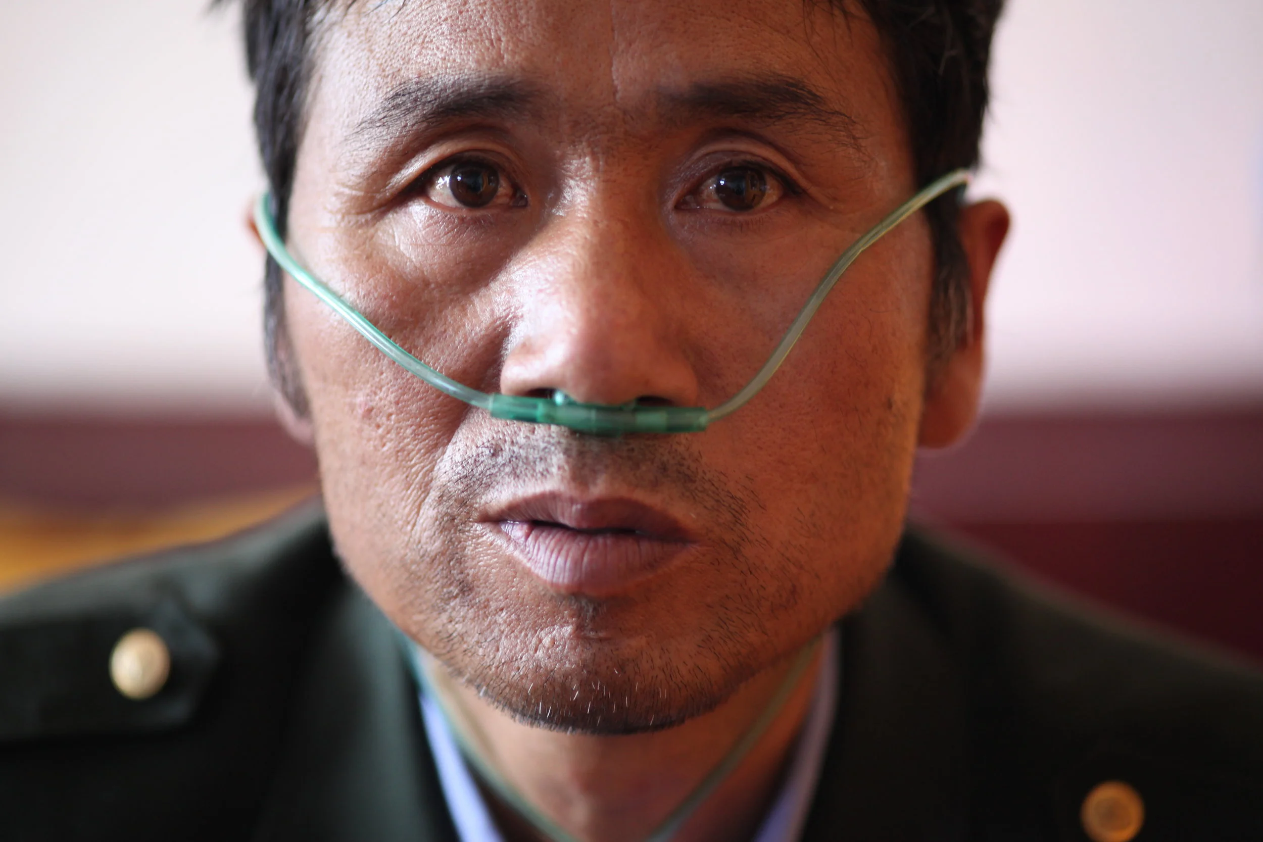 Close-up of a man with a nasal oxygen tube in his nose, wearing a dark uniform with gold buttons.