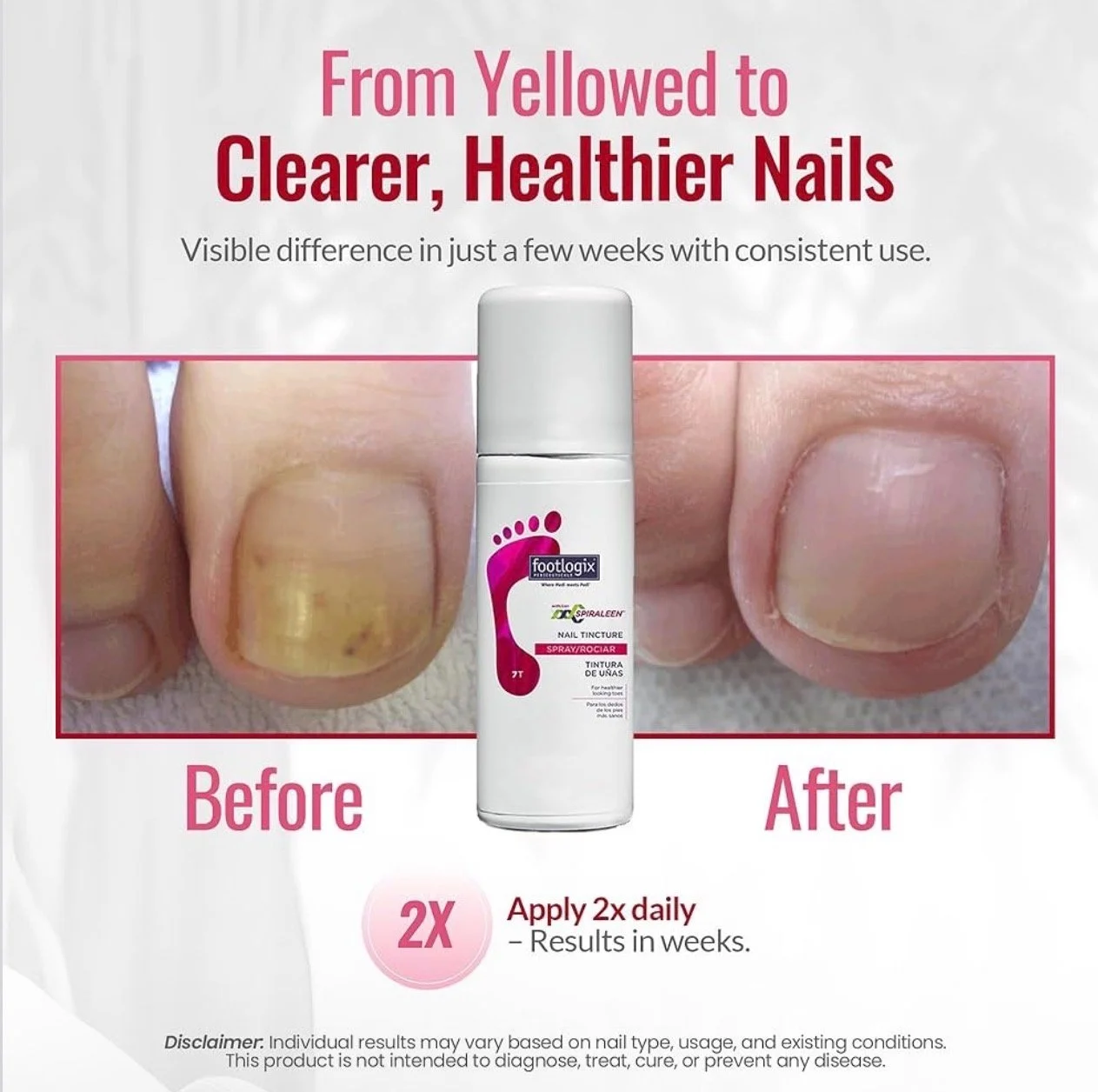 Advertisement showing before and after images of a toenail, with a nail treatment product in the center. The before nail is yellowed and damaged, and the after nail appears healthier. Text indicates the product helps achieve clearer, healthier nails with twice daily application, showing visible results in weeks.