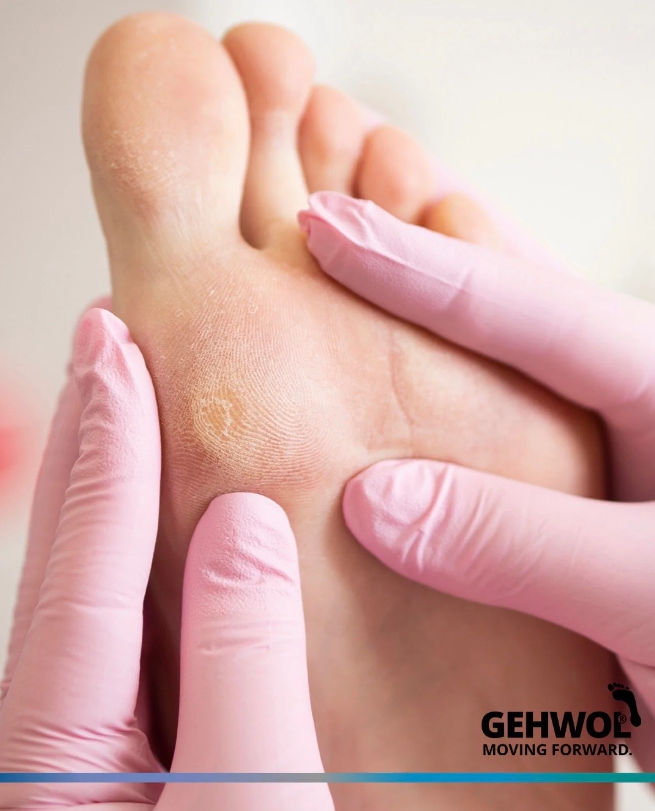 Close-up of a foot being examined or treated, with a healthcare professional wearing pink gloves gently pressing on the sole of the foot.