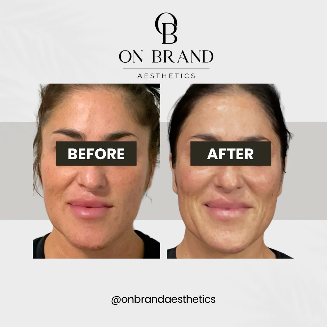 There&rsquo;s something special about the moment after.

The mirror check. The quiet smile.
The subtle shift in confidence you can feel instantly.

These moments are why we do what we do. Not to change someone, but to enhance what&rsquo;s already the