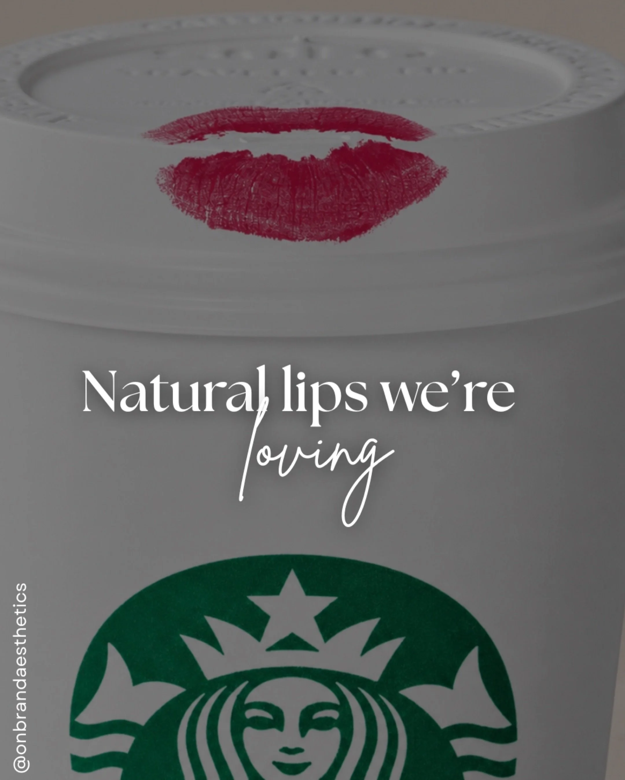 Soft definition, balanced volume, and lips that still look like you &mdash; just refreshed. 

We&rsquo;re loving subtle filler enhancements that hydrate, restore shape, and create naturally fuller lips without looking overdone. The goal will always b