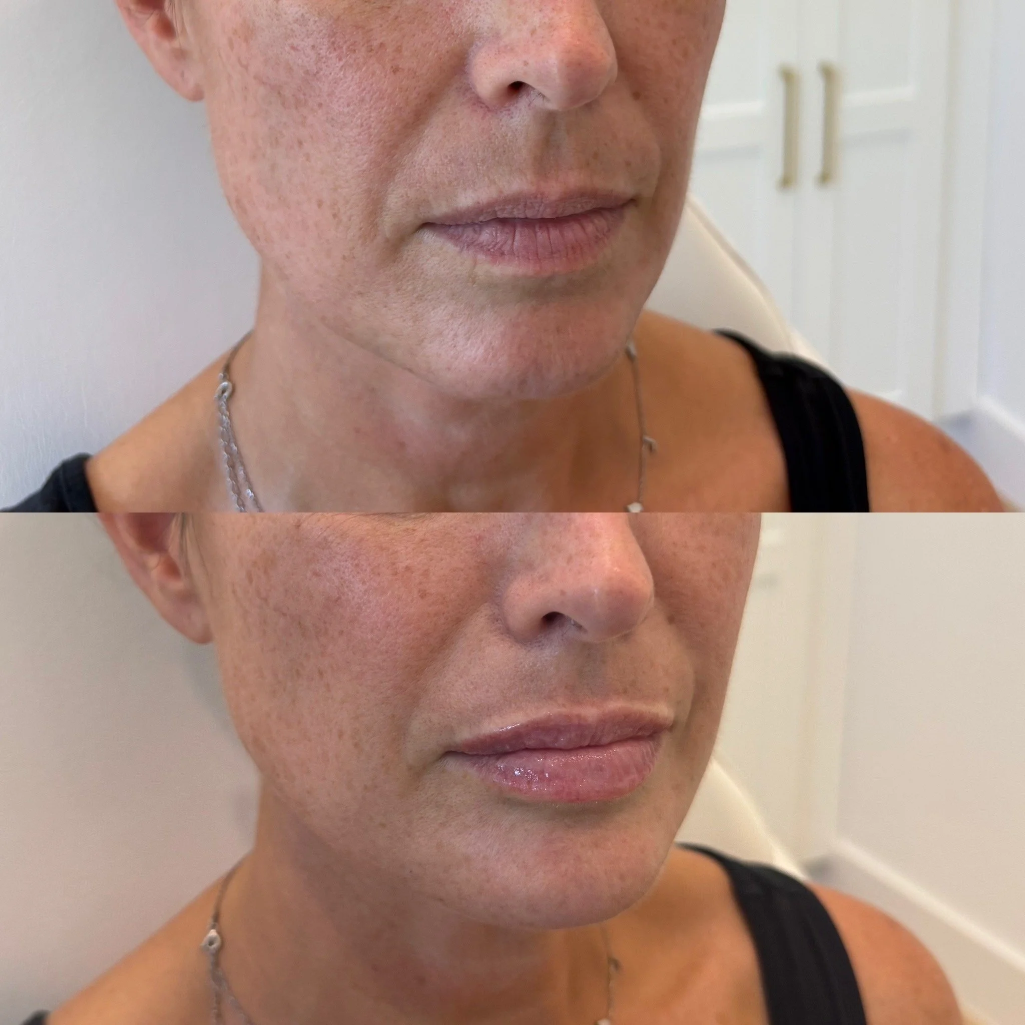 Close-up of a person's face before and after skincare treatment, showing improved skin texture and reduced redness.