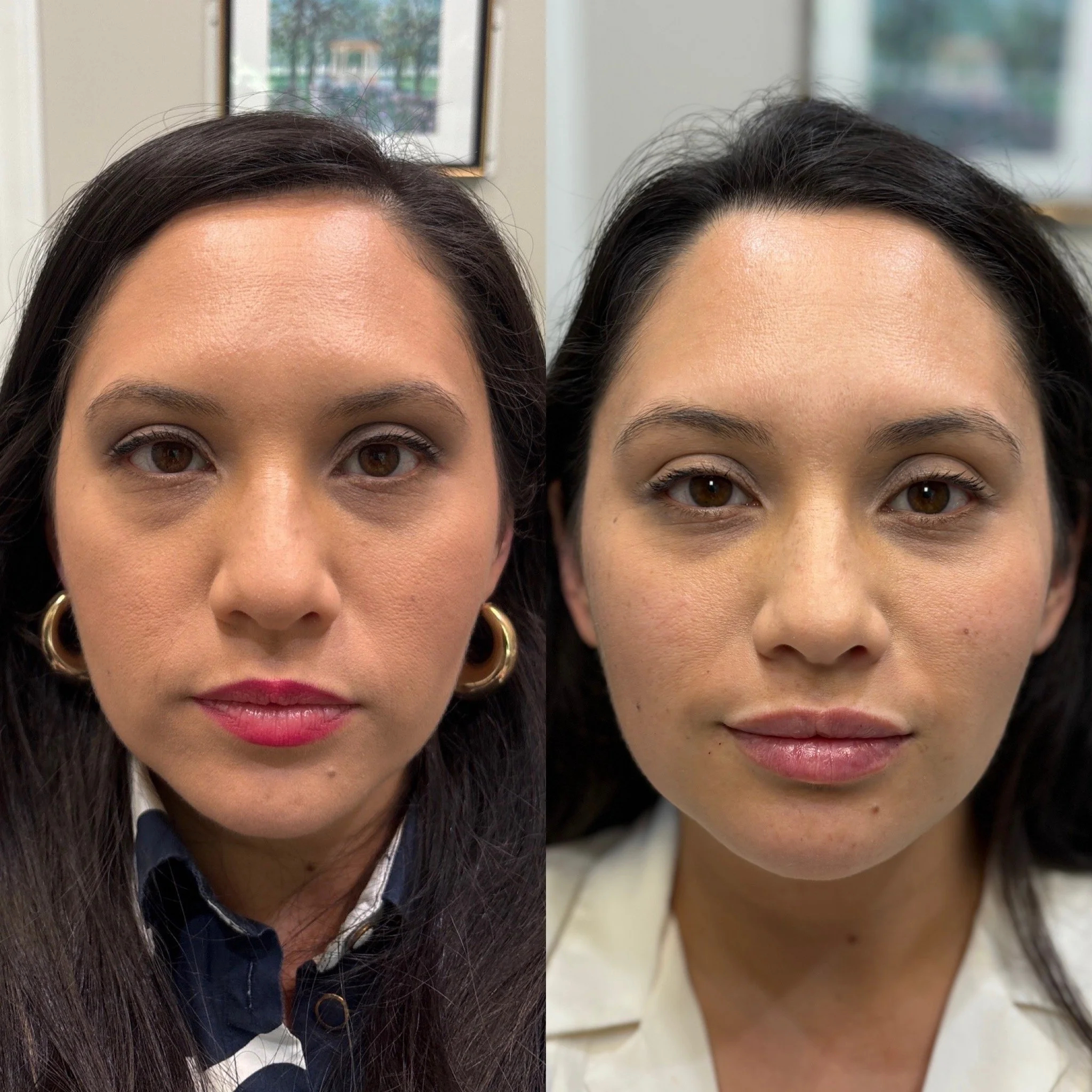 Side-by-side comparison of two women with similar facial features, one with darker hair and one with lighter hair, both looking directly at the camera.