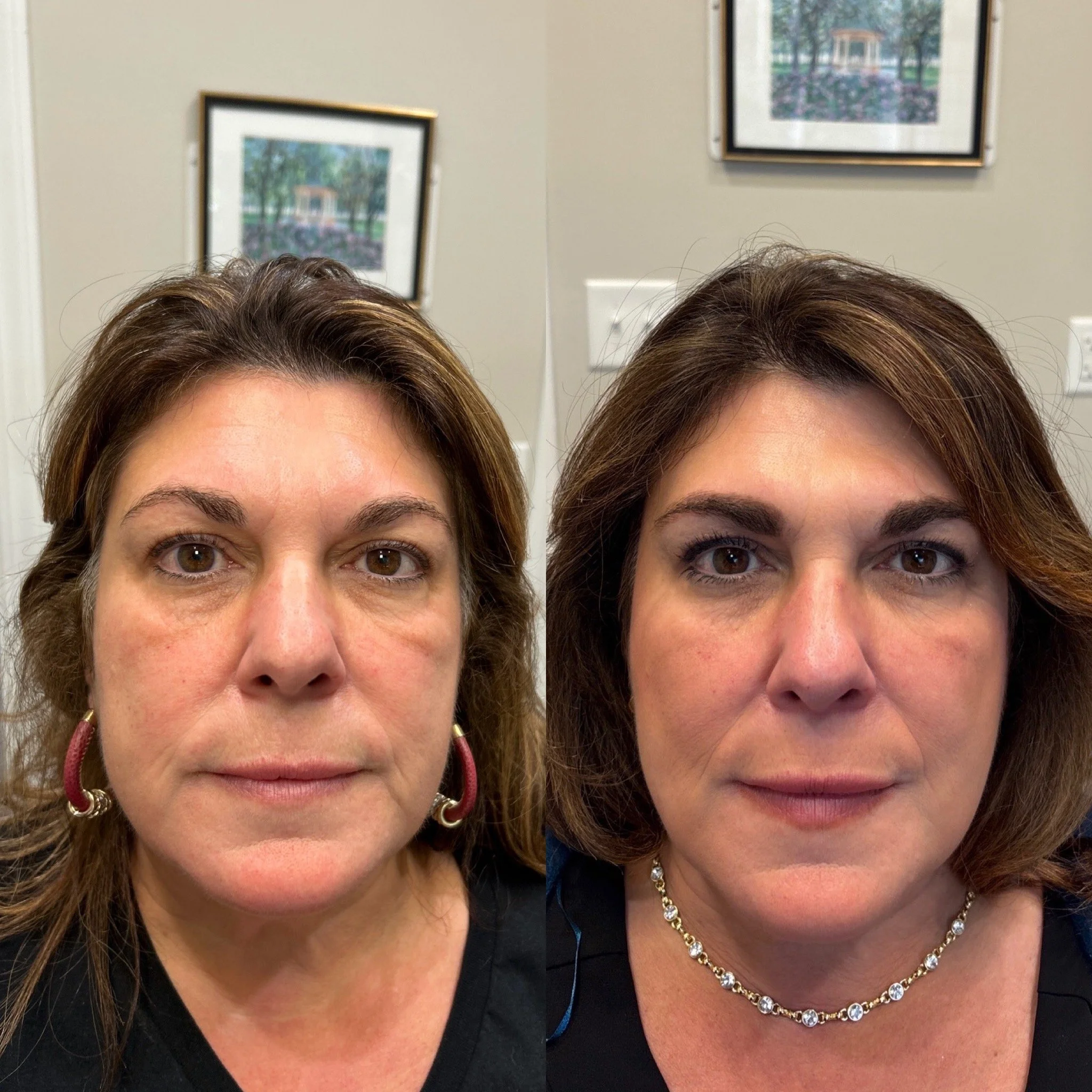 Before and after pictures of a woman showing a transformation in her appearance, likely from a cosmetic or beauty treatment, with different hairstyle, makeup, and jewelry.