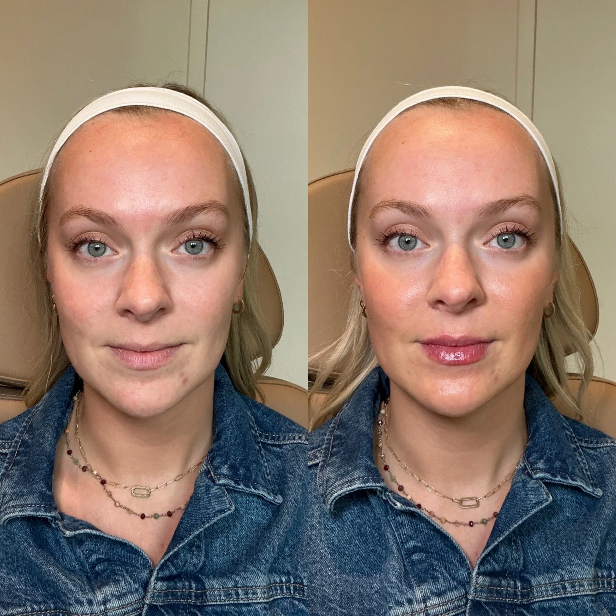 Side-by-side comparison of a woman before and after facial skincare or makeup application, wearing a white headband and denim jacket, with natural lighting.