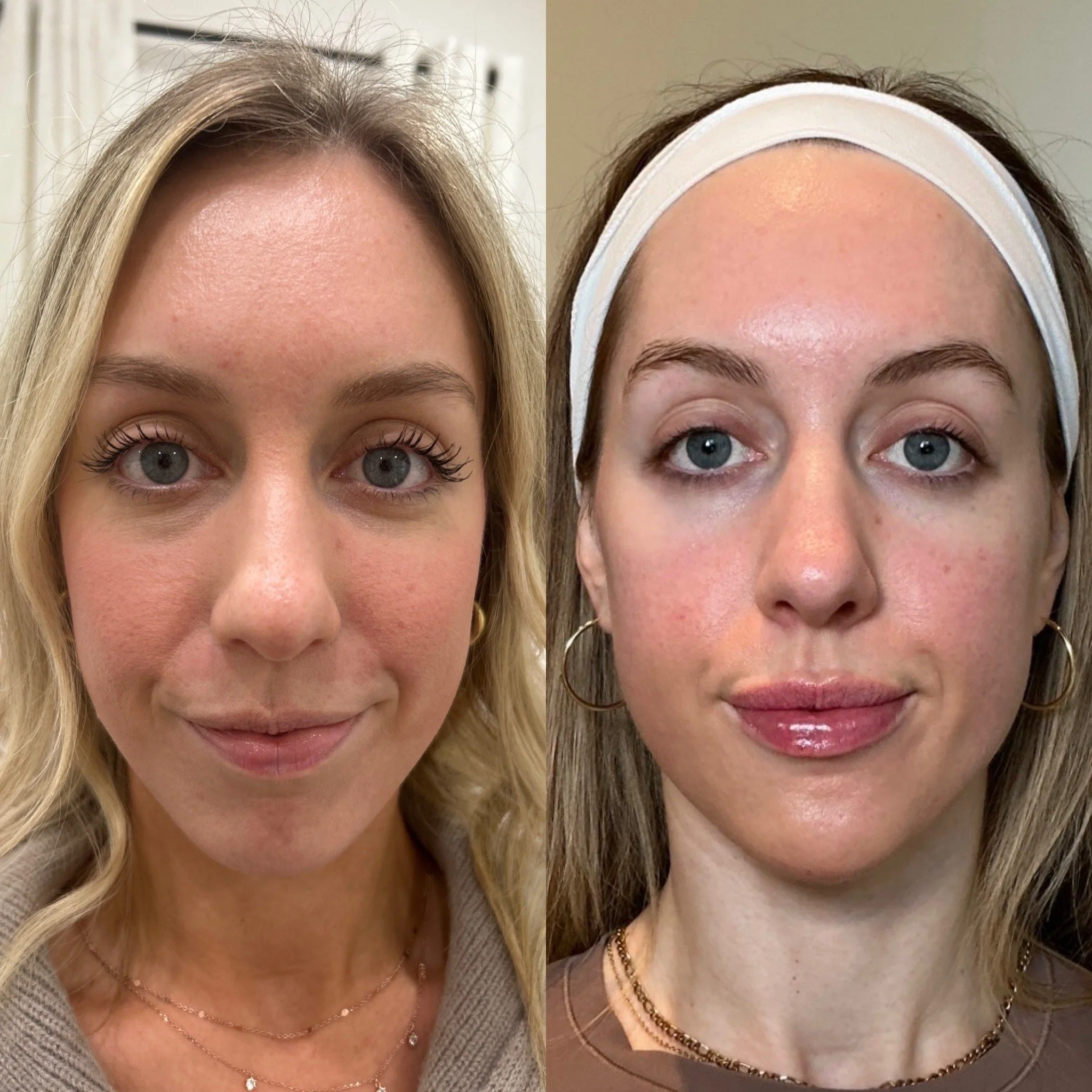Side-by-side images of a woman, showing her before and after a skincare or beauty treatment. The woman has light skin, blue eyes, and blonde hair, wearing jewelry and different clothing in each image.