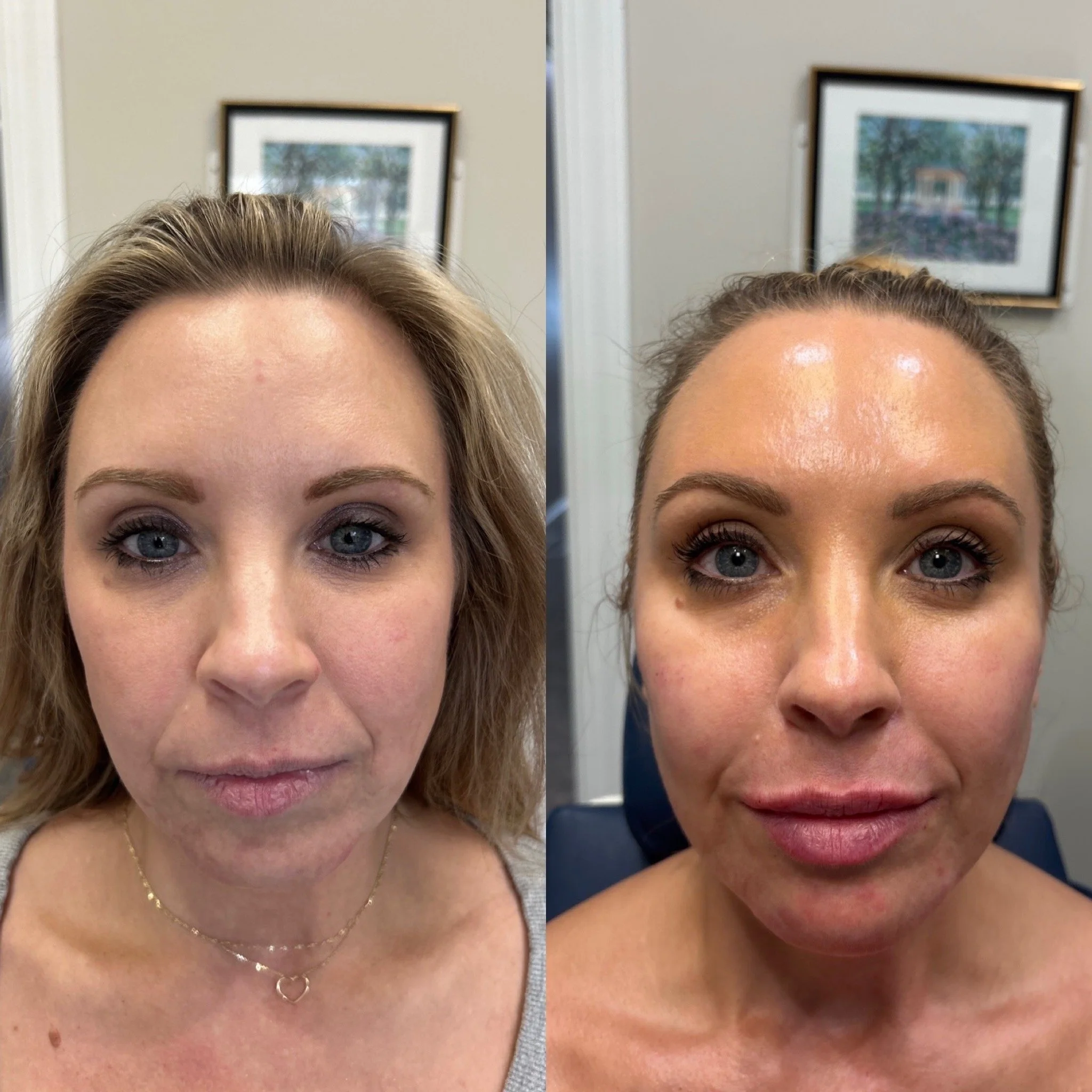 Side-by-side comparison of a woman before and after skincare treatment, showing improved skin texture and glow.