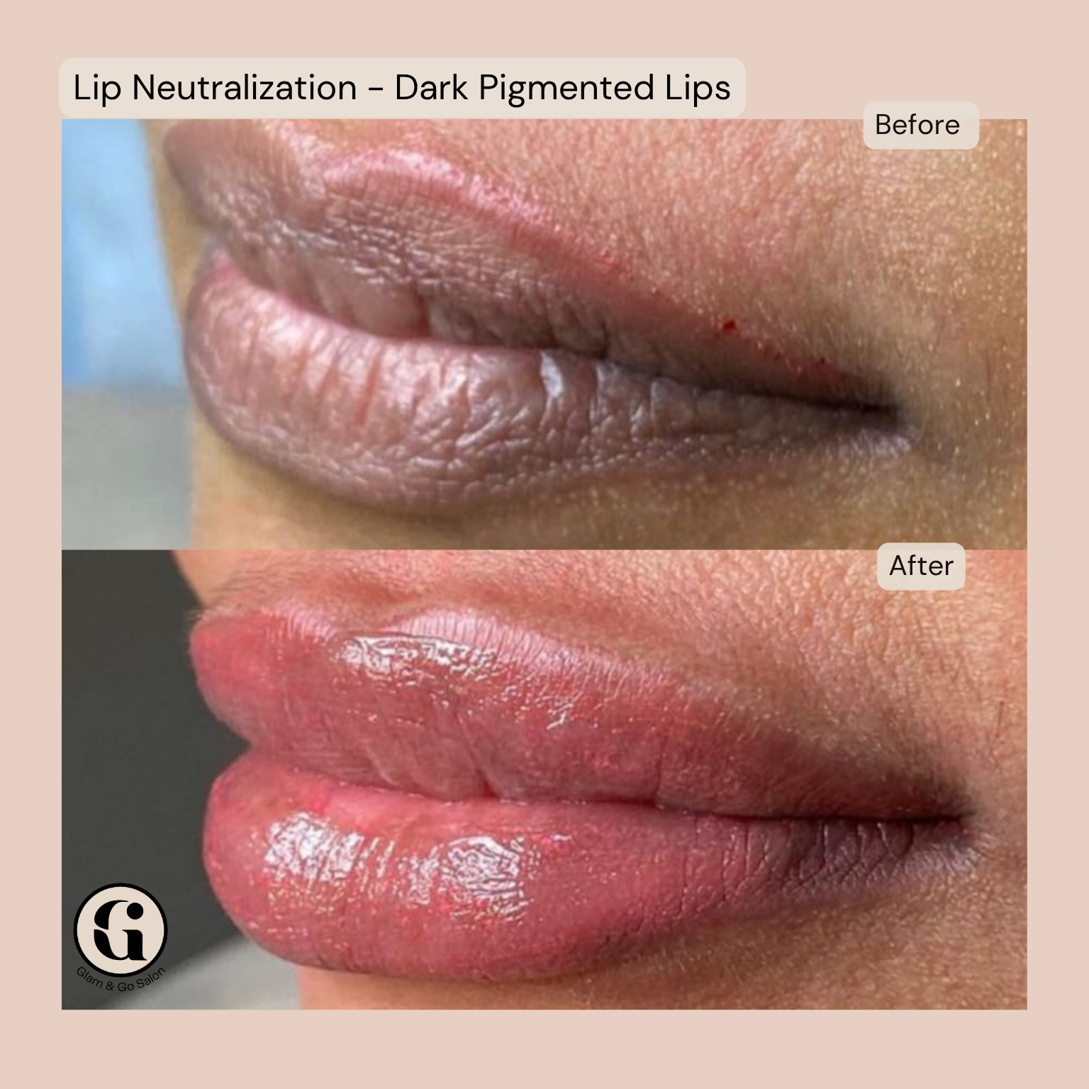 Semi Permanent Makeup Lip Neutralization treatment at Glam & Go Salon JVC Dubai