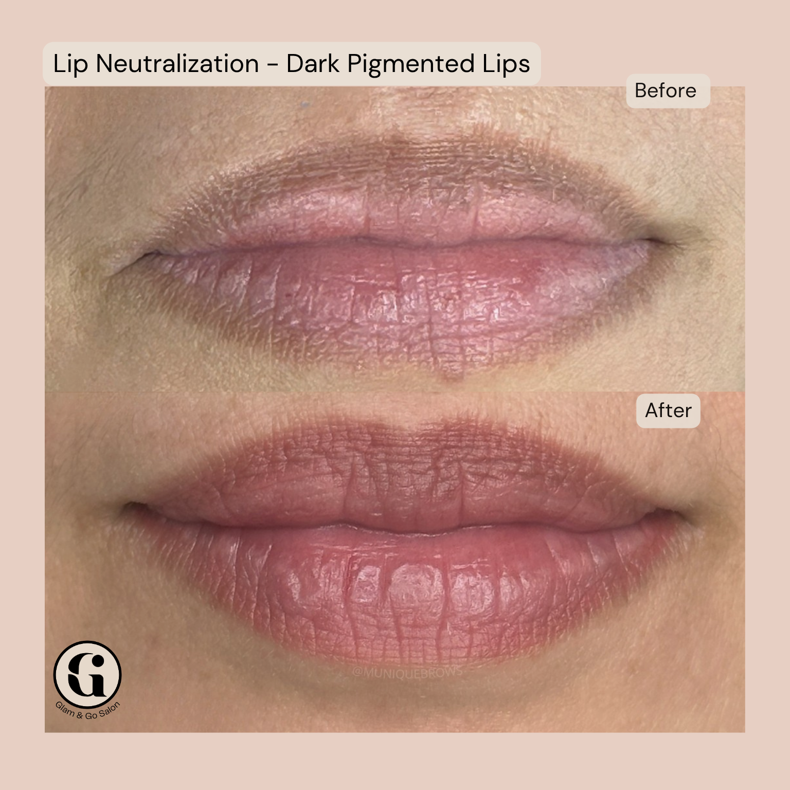 Semi Permanent Makeup Lip Neutralization treatment at Glam & Go Salon JVC Dubai