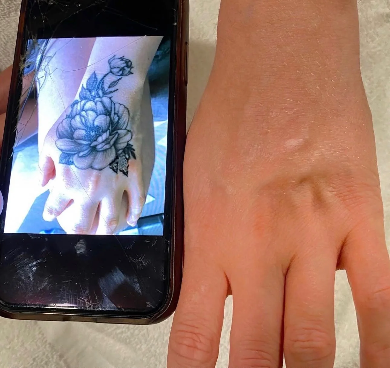 A tattoo of a peony flower on a person's hand, with the tattoo displayed on a smartphone screen, next to the person's bent fingers.