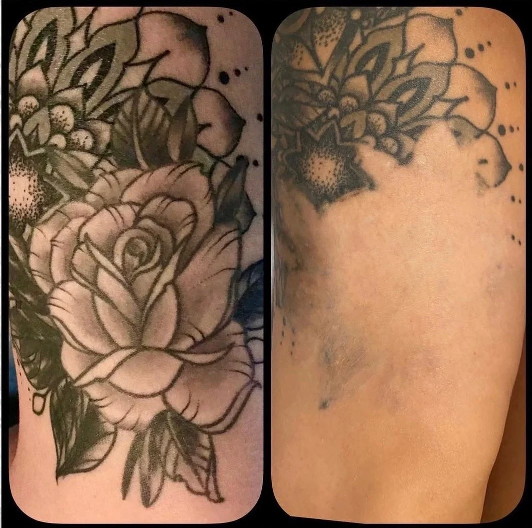 Side-by-side images of tattoos on skin. The left shows a detailed floral tattoo with roses and leaves, and the right shows a partially faded tattoo of a star and floral elements.
