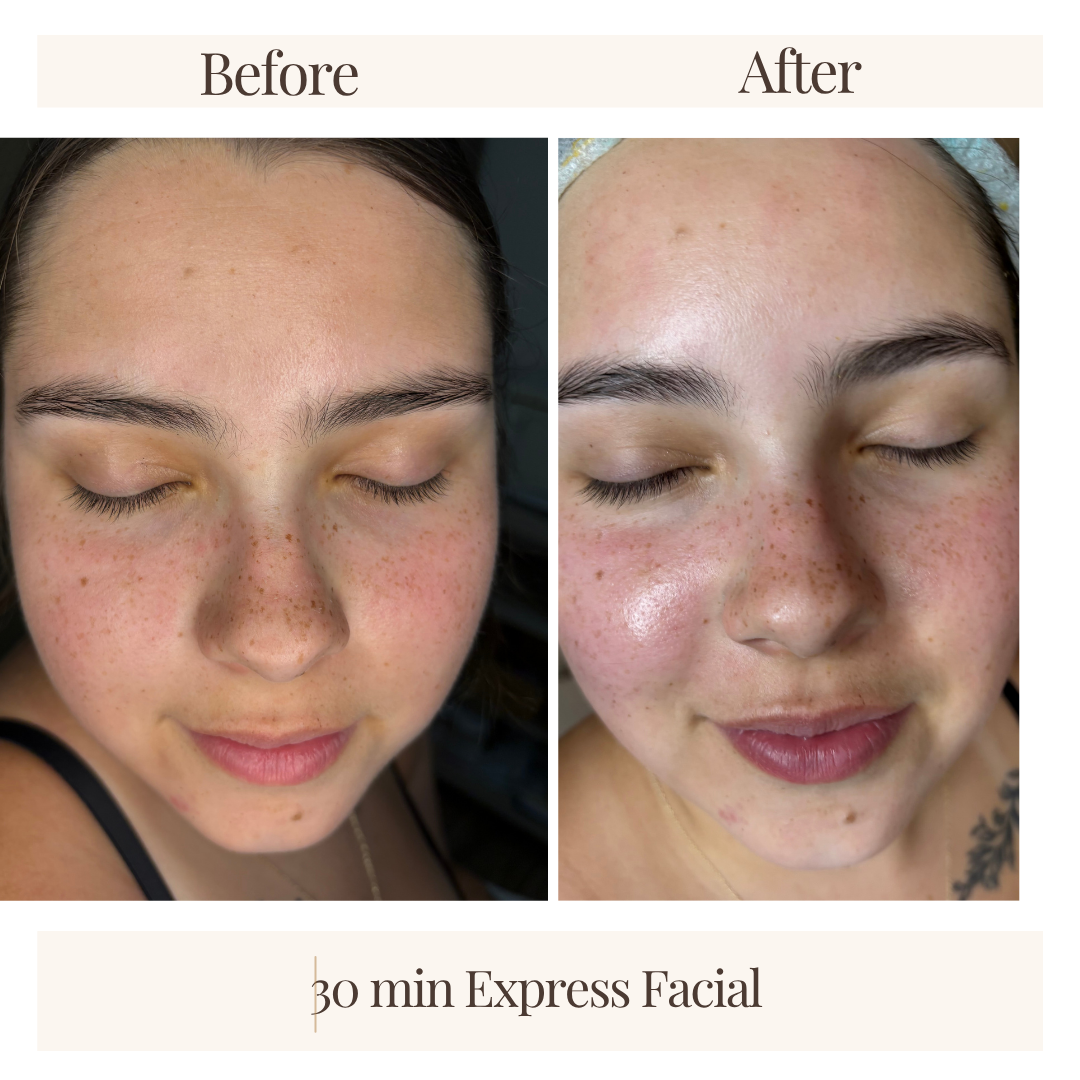 Side-by-side comparison of a woman's face before and after a 30-minute express facial, showing clearer and brighter skin post-treatment.