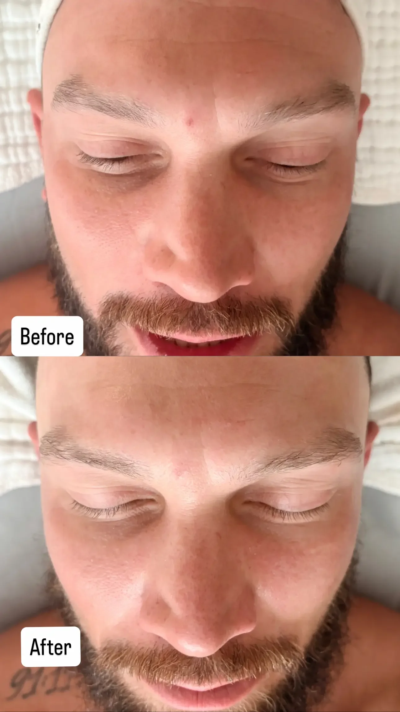 before and after, 32 year old male