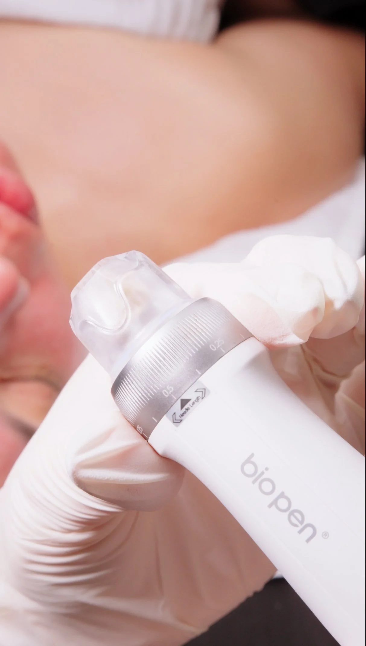 Microagujas y terapia de sonido