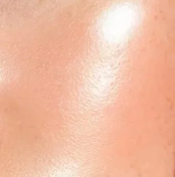 Close-up of smooth, shiny skin with visible pores.