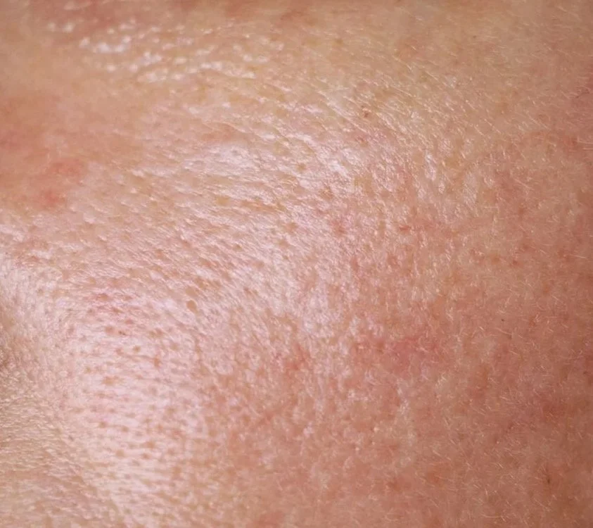 Close-up of a person's skin showing pores and texture