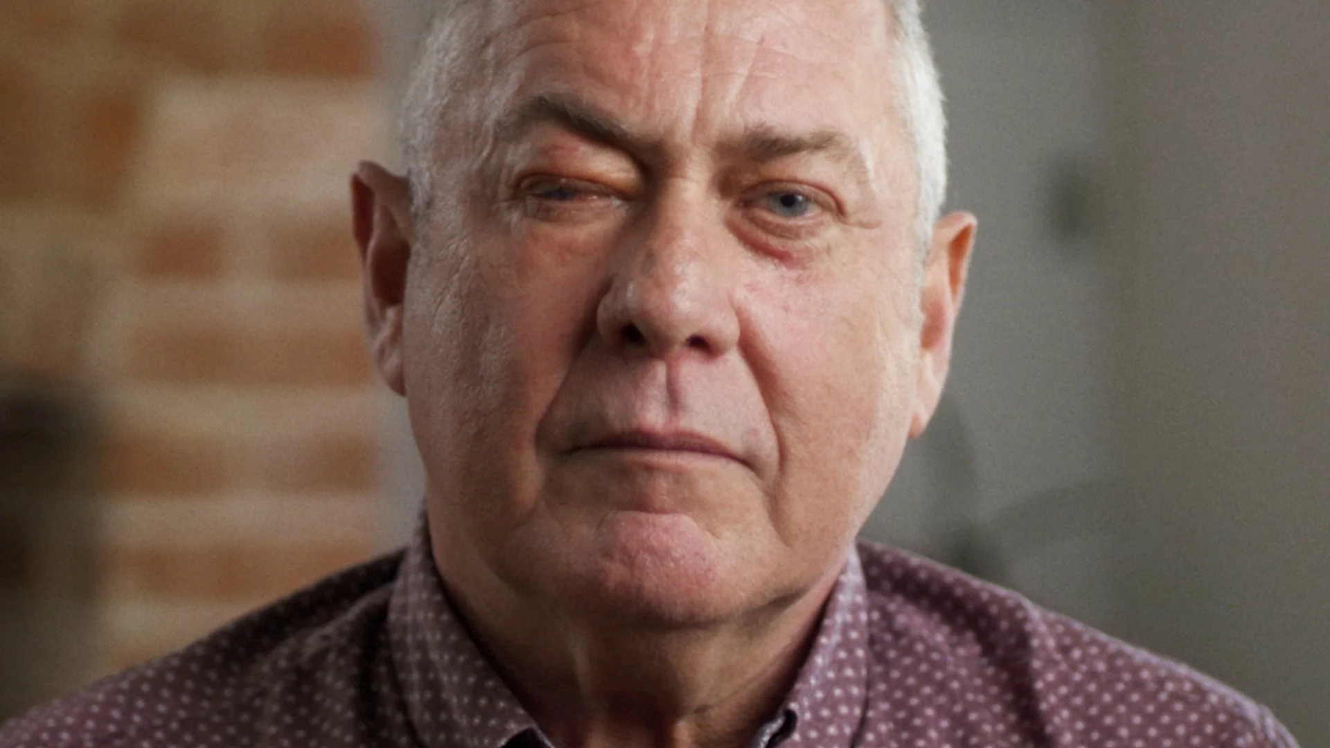 Pete's Life-Changing Injury - RNIB