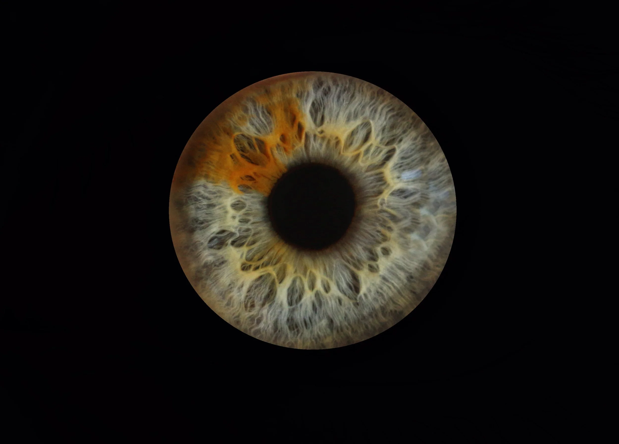 Iridology macro photo for Sarah Murphys book "Modern Iridology"