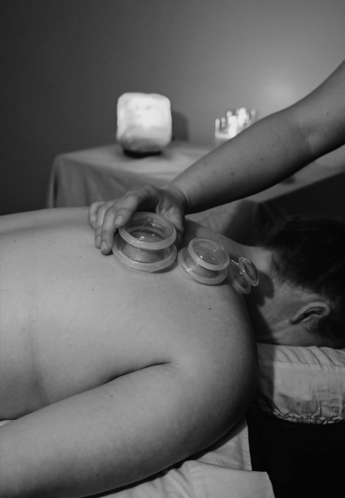 Cupping (add on service only)