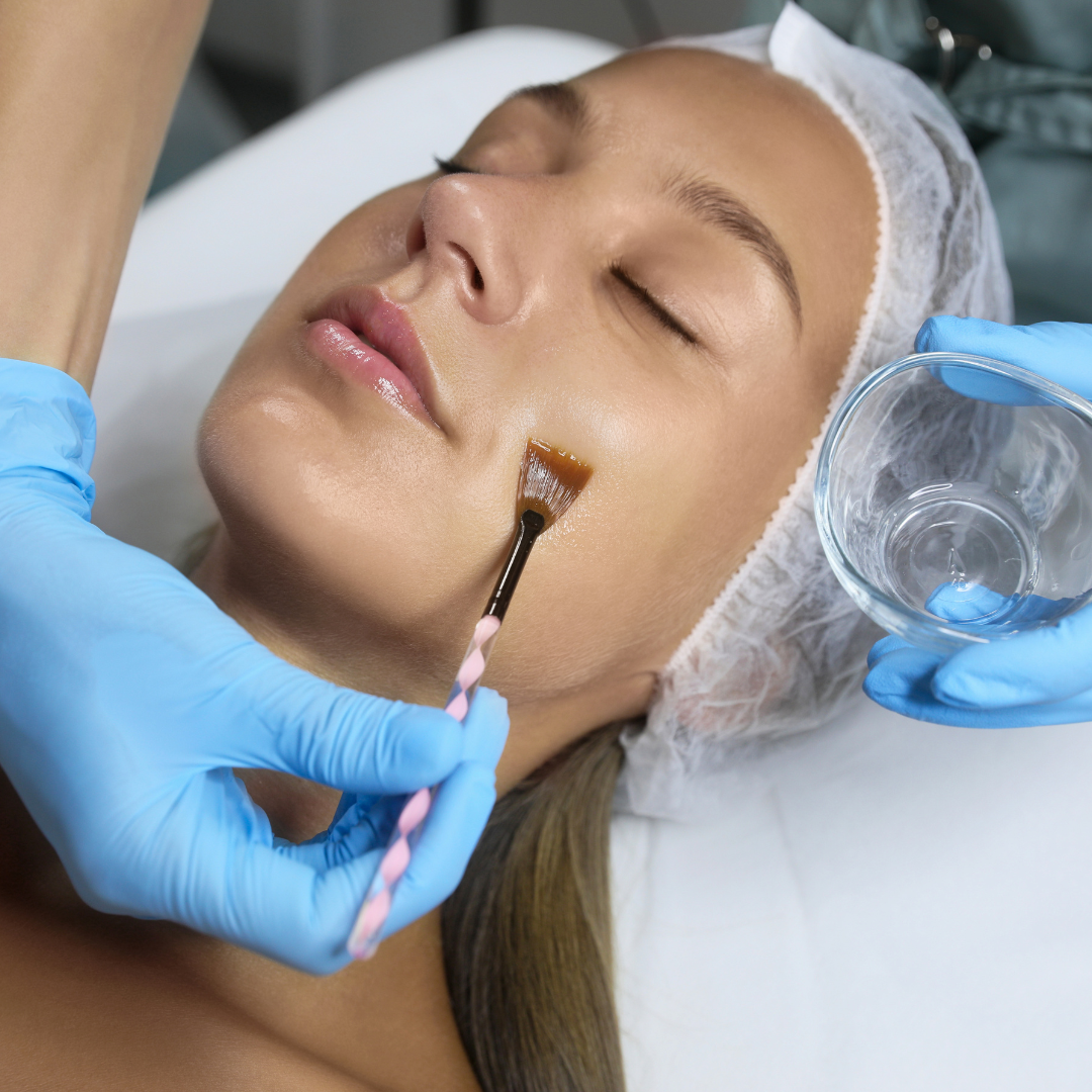 Medspa in Walnut Creek, CA 94598 l Peels Near Me