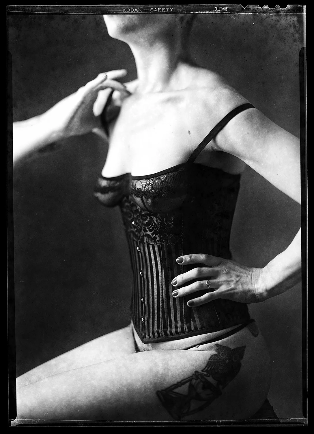 Black and white photo of a woman in a lace and striped corset, with her hand on her waist, and her face and upper chest mostly out of frame.