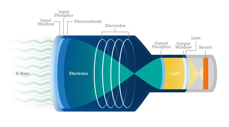 Diagram of a digital camera sensor showing X-rays hitting the sensor, electrons being generated, and light passing through to the lens.