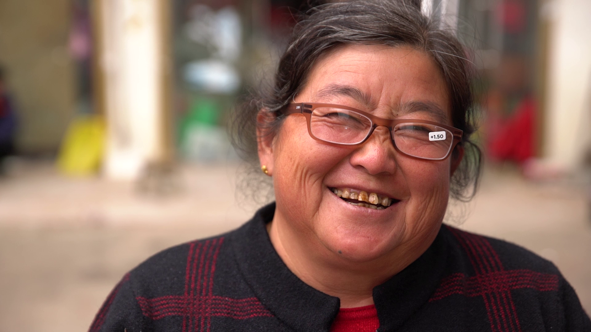 A smiling woman with glasses showing tooth discoloration and missing teeth.