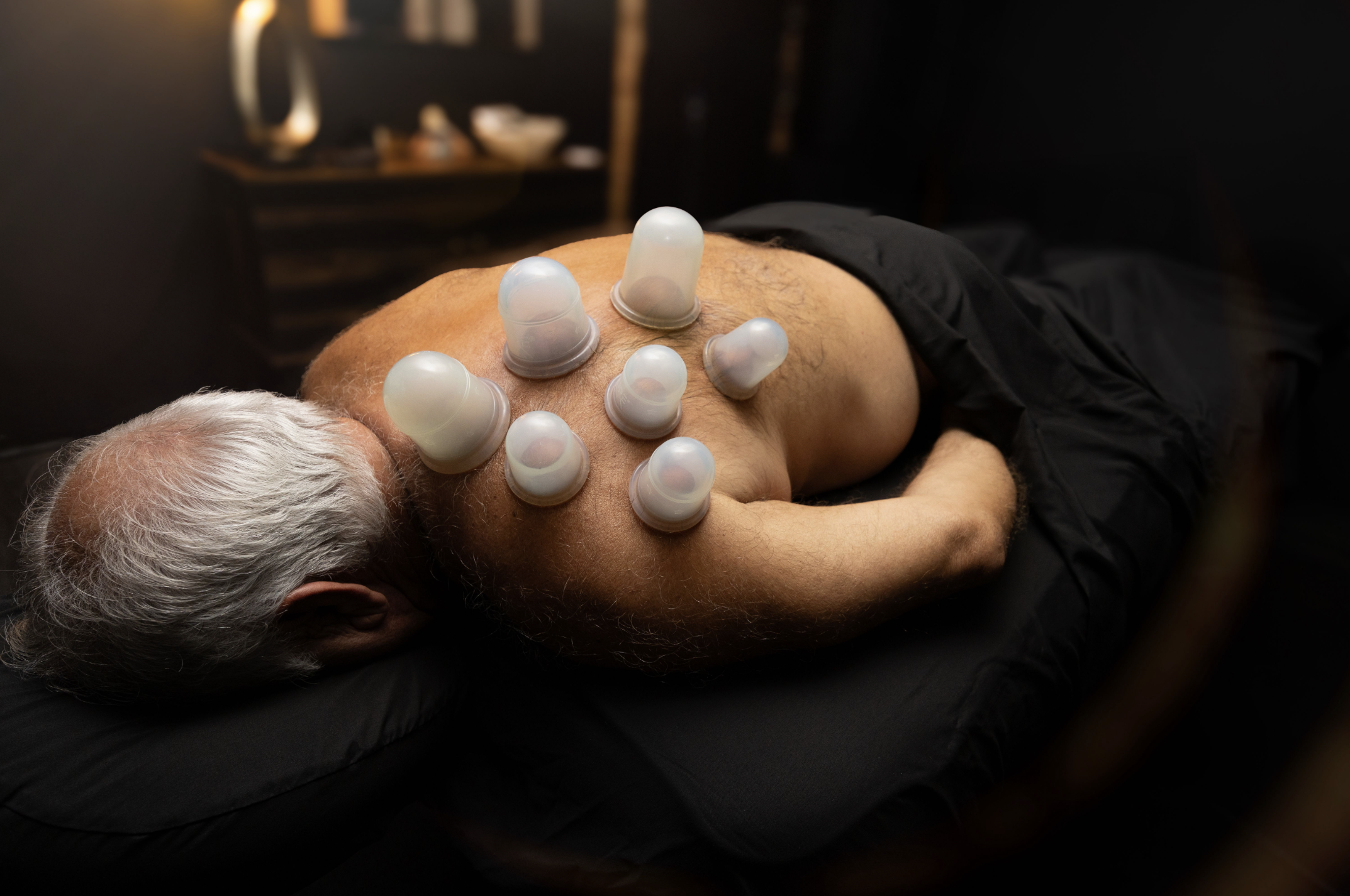Cupping Therapy
