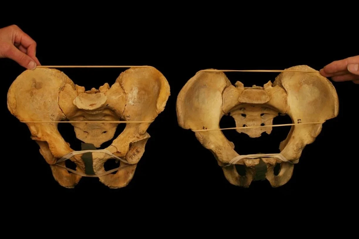 Pelvic Asymmetry: The Invisible Problem That Shapes Everything