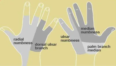 Bike Fit for Hand Numbness: Why Your Hands Go Numb While Cycling