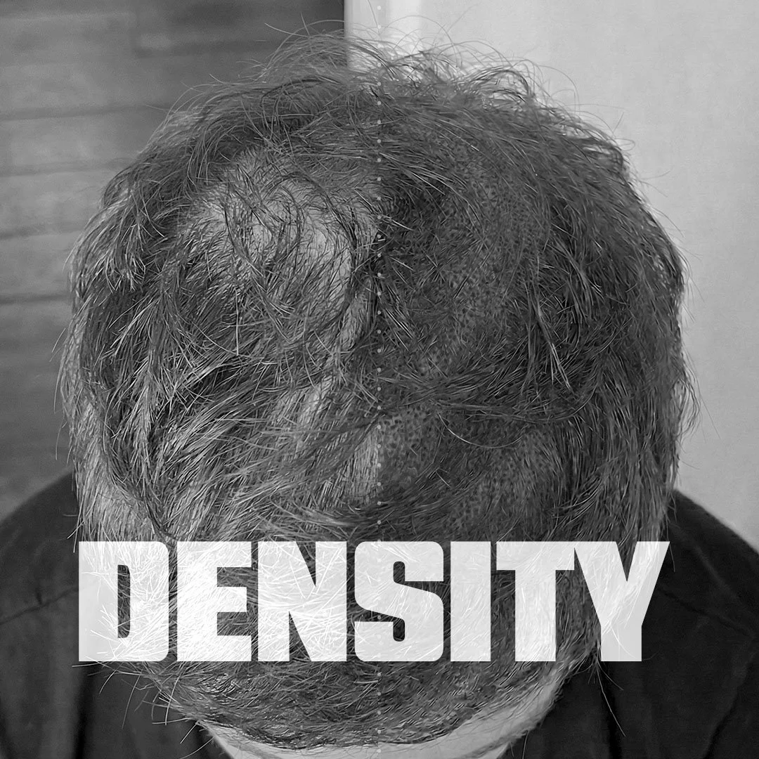 Density Treatment