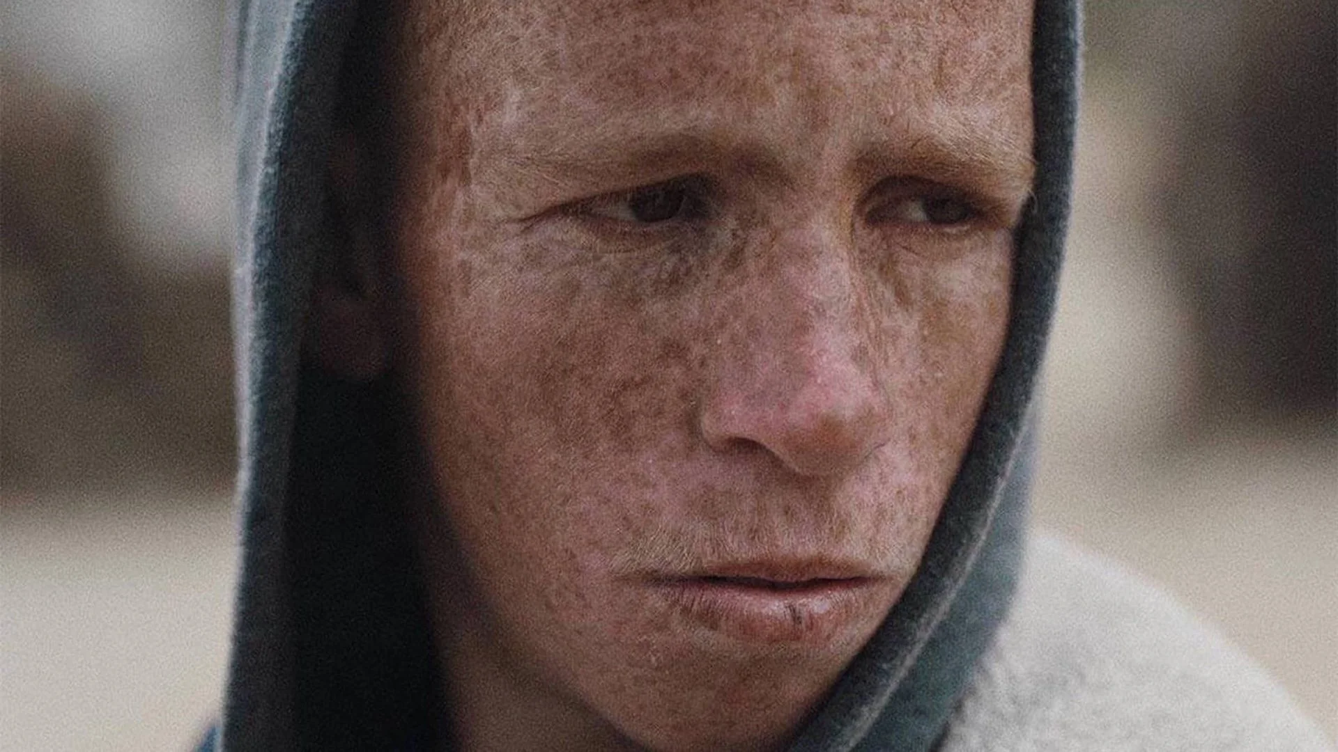 Close-up of a person's face with freckles, hooded in a gray hoodie, looking down with a somber expression
