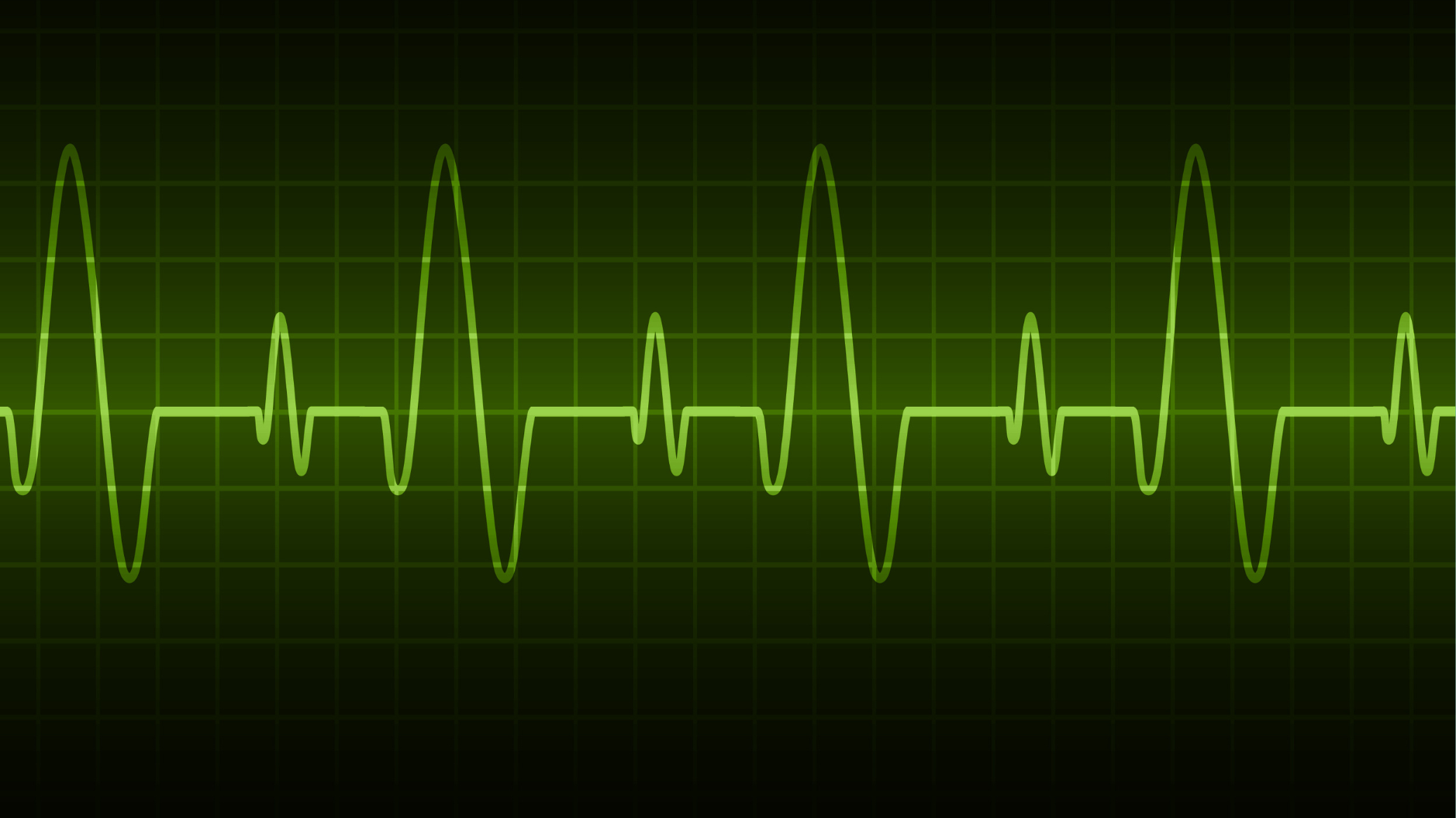 Þarf ég að bíða eftir að á­lagið hætti eða get ég haft á­hrif?