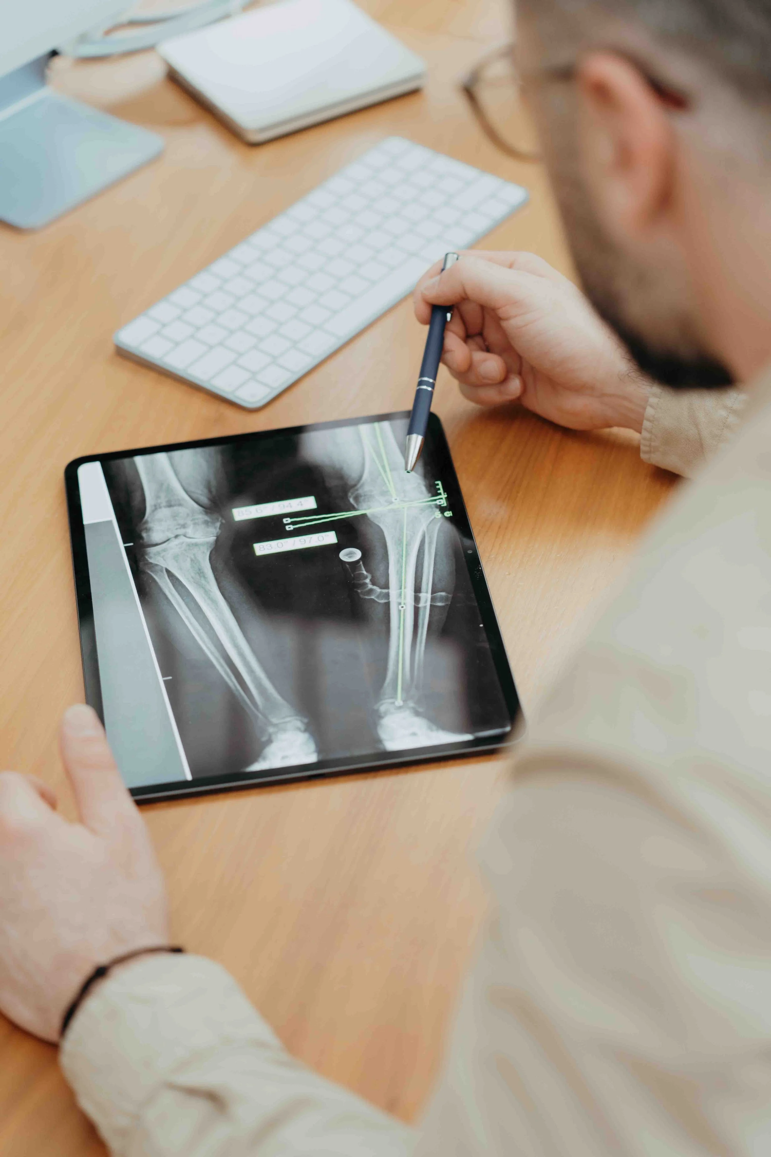 Arzt analysiert eine Röntgenaufnahme eines menschlichen Beins auf einem Tablet.