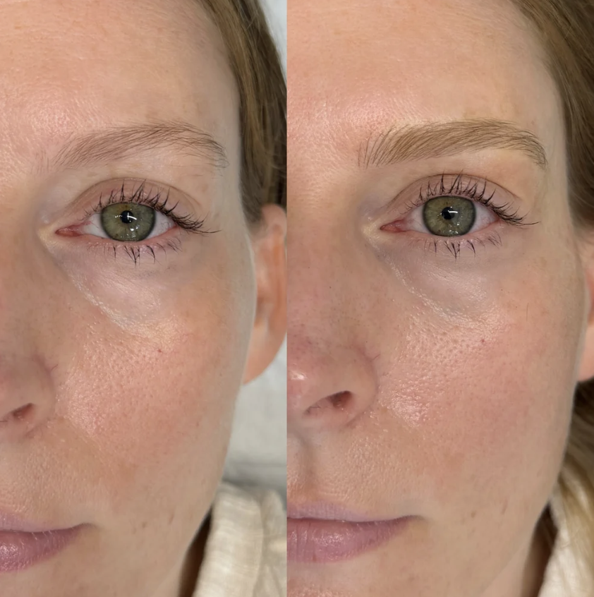 Close-up of a woman's face before and after eyebrow grooming, showing improved eyebrow shape in the after image.