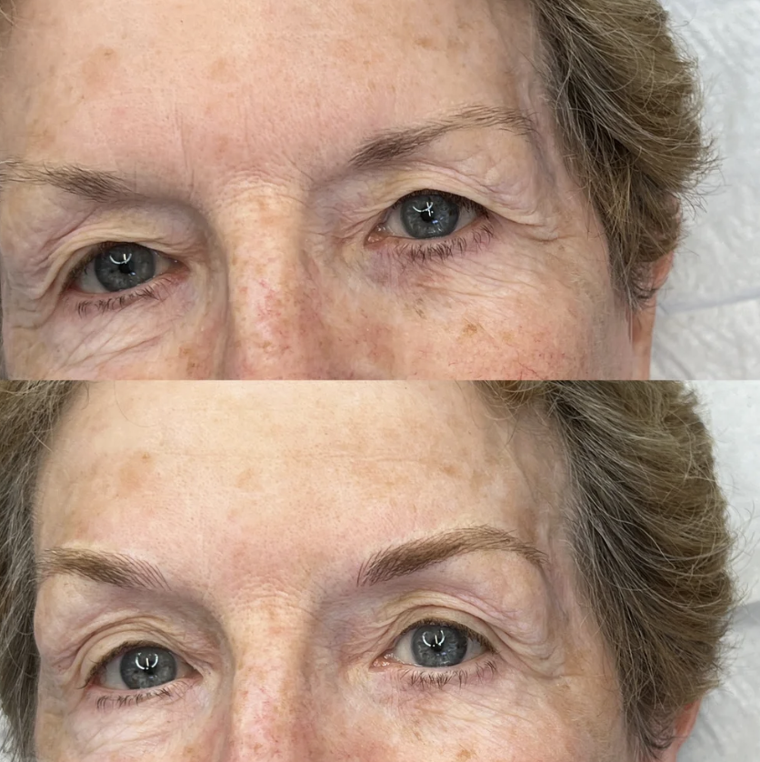 Close-up of a woman's face showing before and after eyebrow enhancement, with visible improvements in eyebrow shape and fullness.