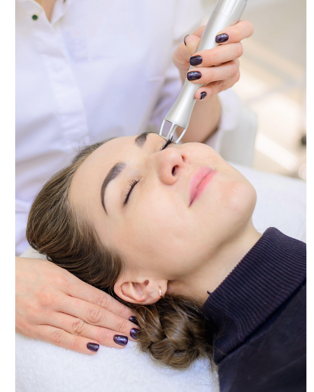 LUMILASER fractional co2 machine face treatment.png