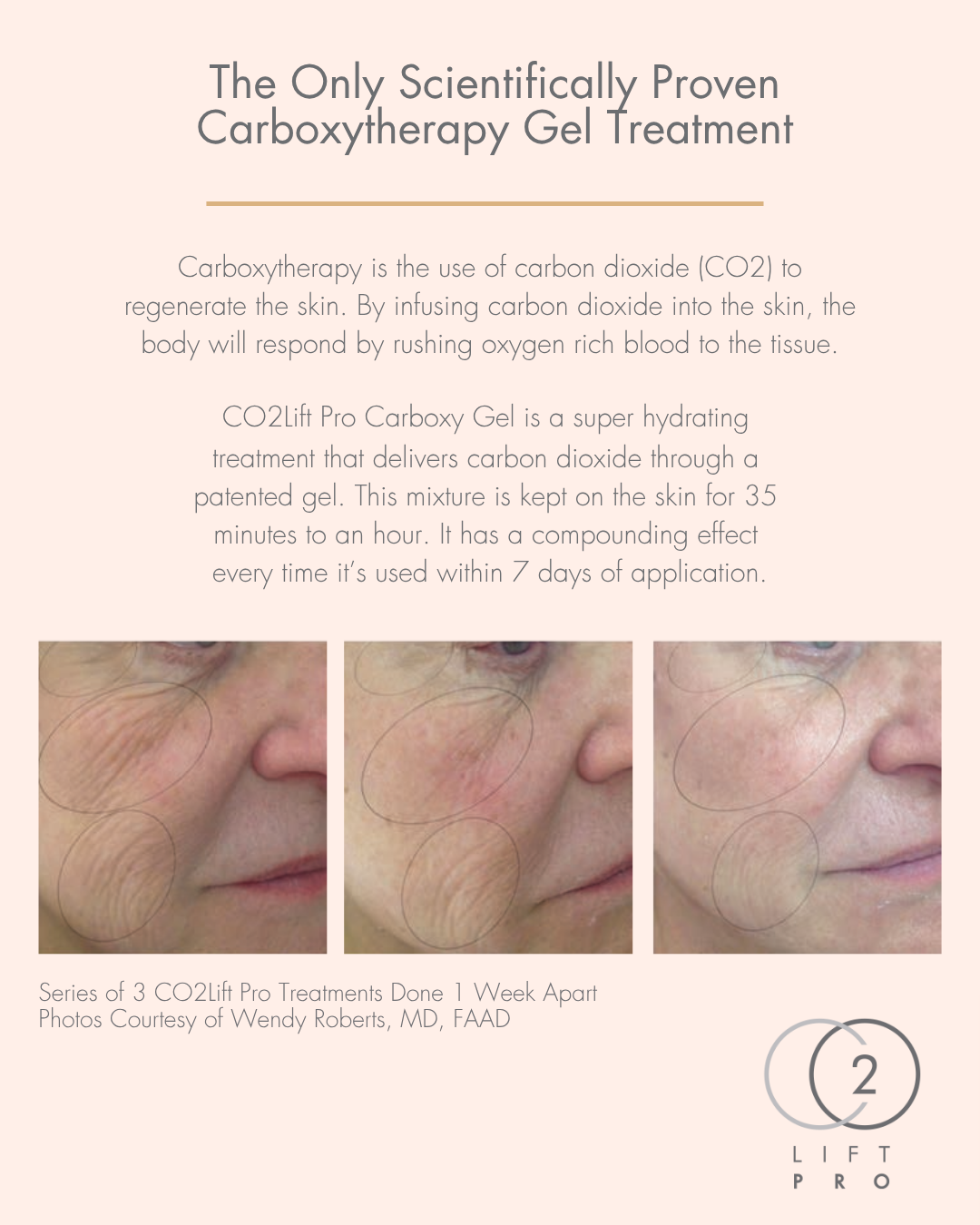 Accelerate repair &amp; renewal with CO2Lift Pro