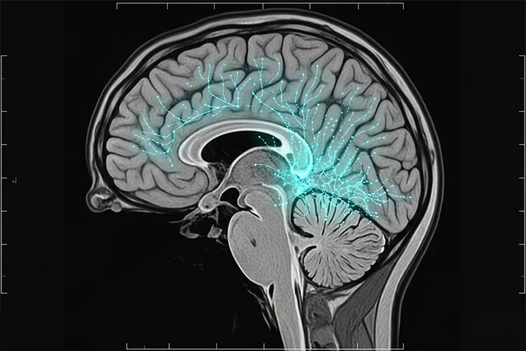 Cancer Drugs for Alzheimer’s? The Next Frontier in Dementia Treatment