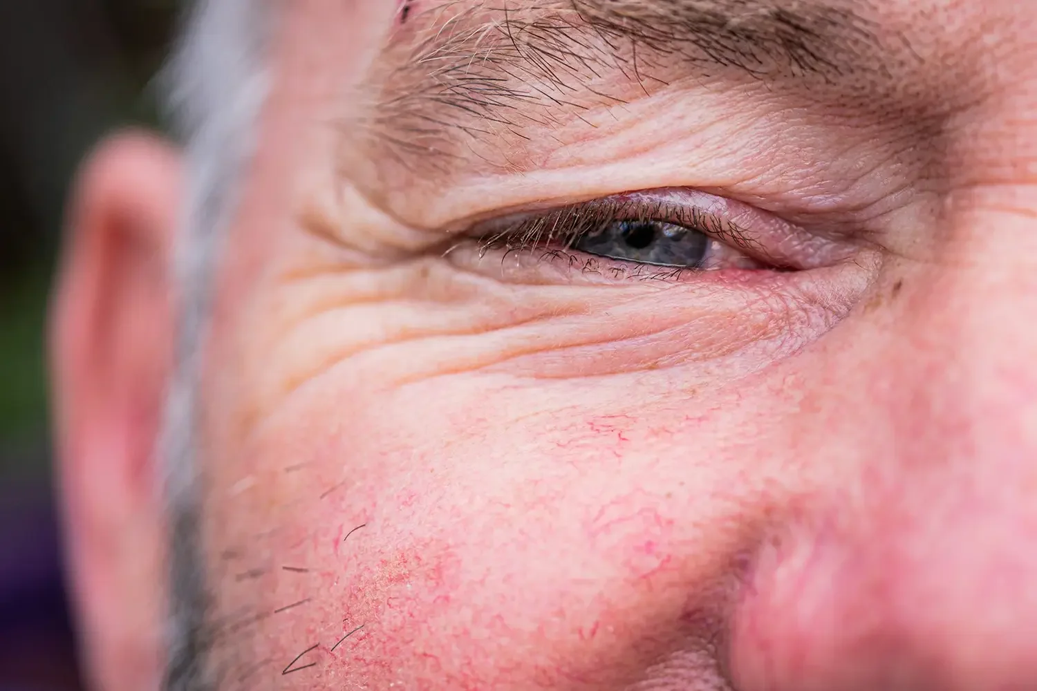 Brotox: Don’t Let Your Face Misread Your Intent