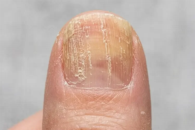 A close-up of a thumbnail with a yellow hue.