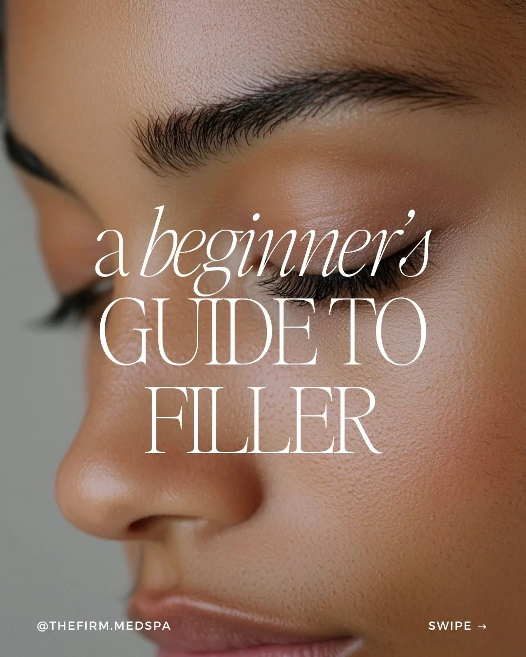New to dermal filler? Let&rsquo;s break it down.
Dermal filler is most commonly made from hyaluronic acid, a substance your body already produces to support hydration and structure in the skin.
As we age, we naturally lose volume and support in certa