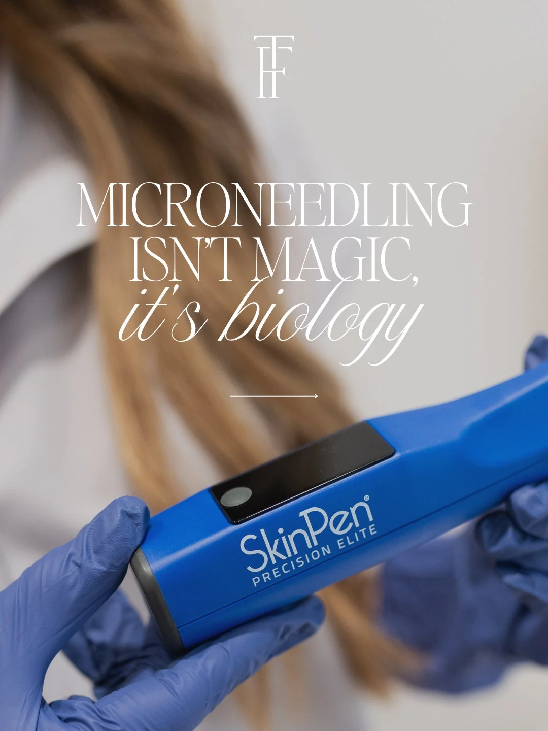 Microneedling works with your skin, not against it.
By creating tiny controlled micro-injuries in the skin, microneedling triggers your body&rsquo;s natural healing response which stimulates:
✨ Collagen production
✨ Elastin formation
✨ Improved skin 