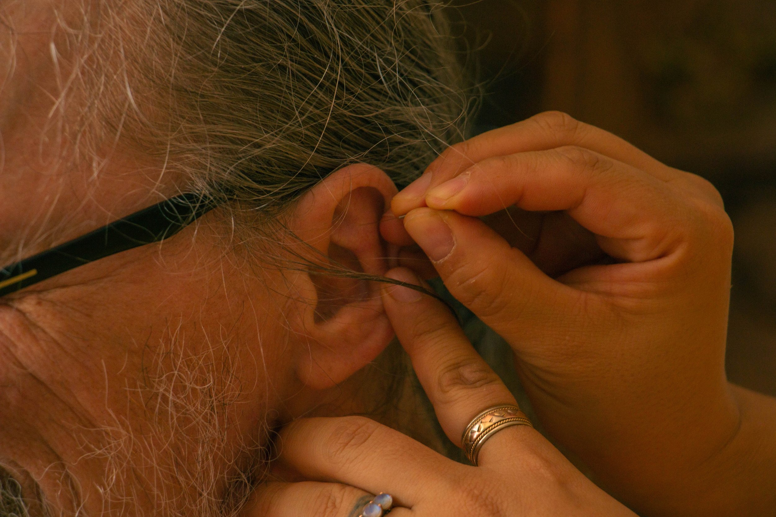 Community Acupuncture