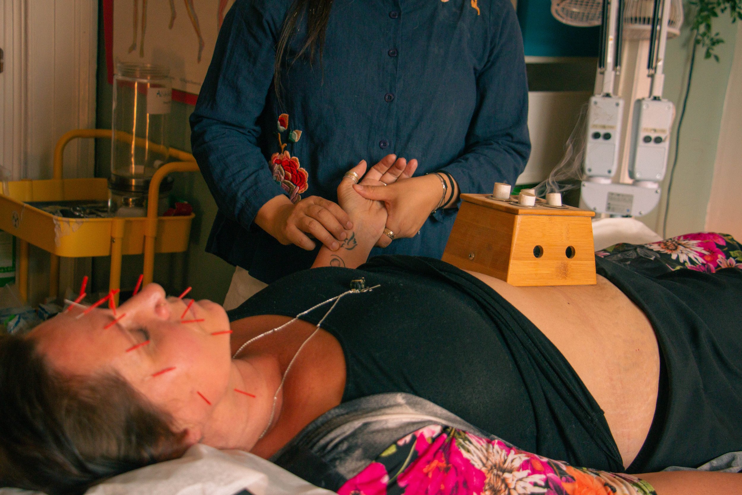 Follow-Up Acupuncture Treatment With Moxibustion